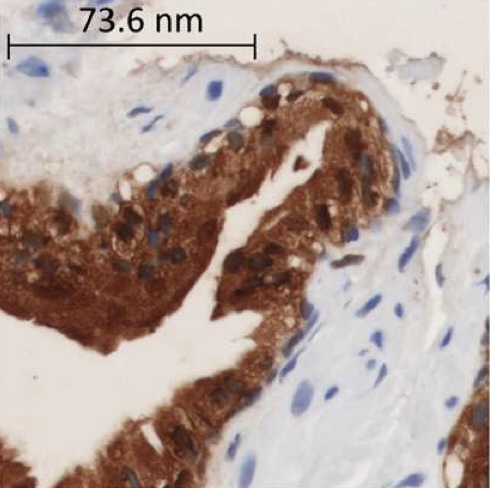 Quality Evaluation of Microscopy and Scanned Histological Images for Diagnostic Purposes