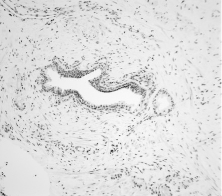 Evaluation of Autofocus Measures for Microscopy Images of Biopsy and Cytology