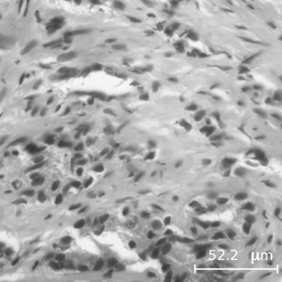 Autofocus Evaluation for Brightfield Microscopy Pathology