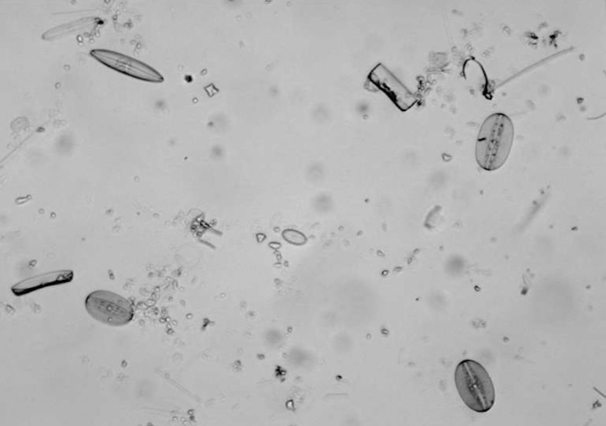 Automatic Screening and Multifocus Fusion Methods for Diatom Identification