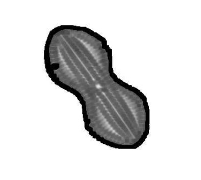 Diatom Screening and Classification by Shape Analysis