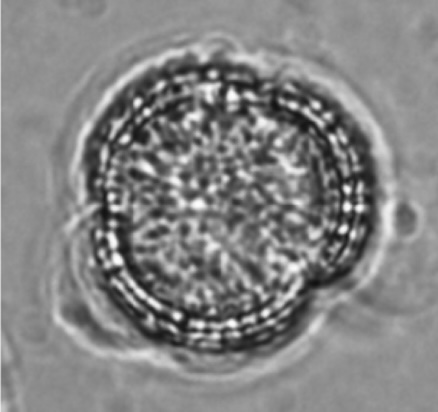 Automated Pollen Identification Using Microscopic Imaging and Texture Analysis