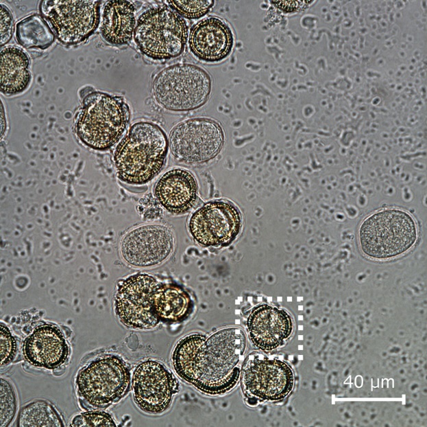 Pollen Segmentation and Feature Evaluation for Automatic Classification in Bright-Field Microscopy