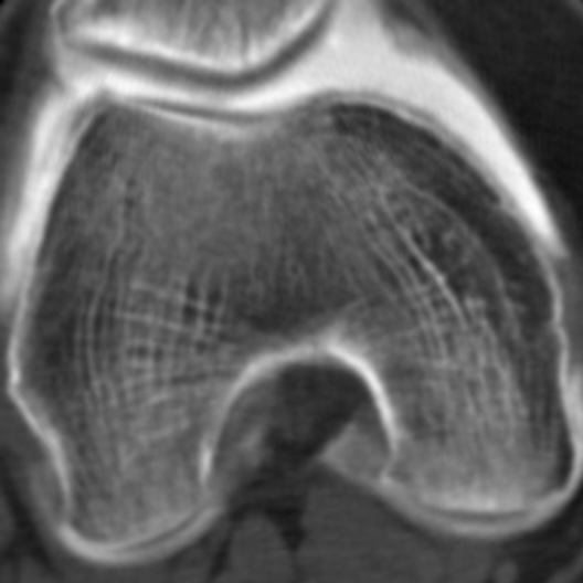 Texture Segmentation and Analysis for Tissue Characterization